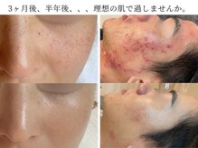 ハナコ 下通店(HANAKO)