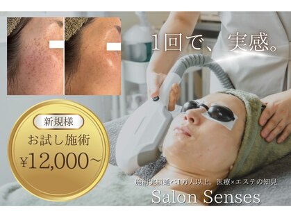 センシズ(Senses)の写真