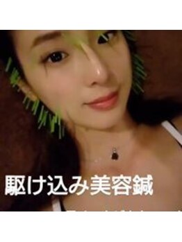 ルディア 堂島店(ledia)/大阪美容鍼 モデル 鈴木望様