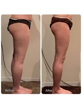 サロンドカイ(Salon de Kai)/痩身プログラム　4か月