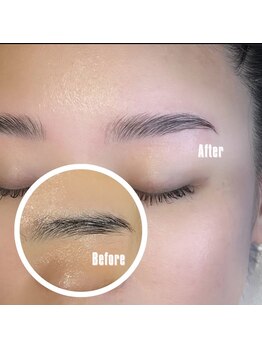 フルアナ(Hu ruana)/ハリウッドブロウリフト