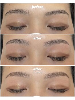 ティニー(Tiny)/HBL