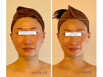 パル コルギサロン(Pal. Korugi salon)/コルギビフォーアフター