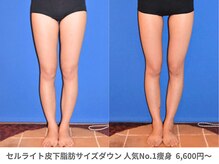 アンシャンテ 神戸元町店(Enchante)/痩身ダイエット　神戸元町三ノ宮