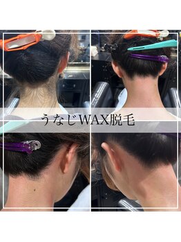 ミズマニア(mizmania)/うなじ脱毛/本厚木/厚木/海老名