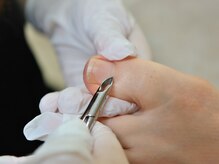 シャンティ(Shanti)/甘皮のケア