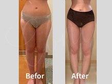 ヨサパーク コニ 古国府店(YOSA PARK Coni)