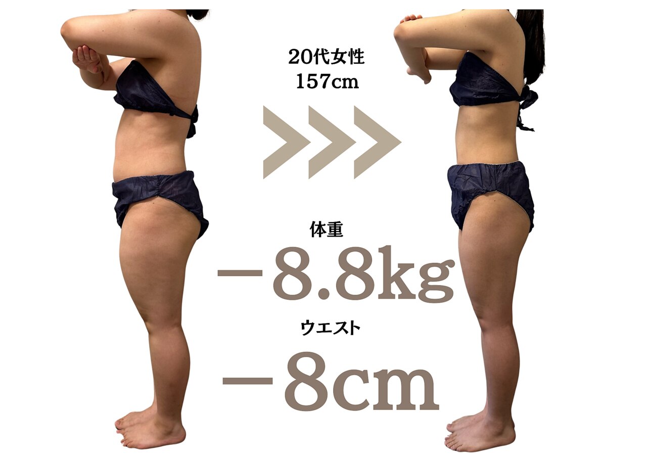 彦根市でキャビテーションが人気のエステサロン｜ホットペッパー