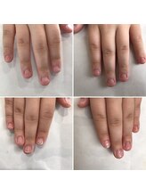 ネイルデコ(nail DECO)/自爪育成3回コース