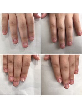ネイルデコ(nail DECO)/自爪育成3回コース