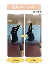 いみすぽ整体/30代女性ビフォアアフター