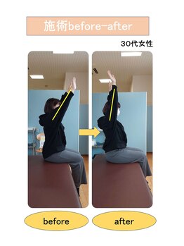 いみすぽ整体/30代女性ビフォアアフター