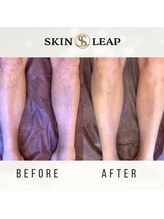 スキンリープワックスサロン 川崎店(SKINLEAP Wax salon)/脚脱毛【男性】