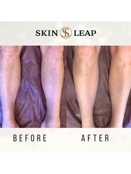 スキンリープワックスサロン 川崎店(SKINLEAP Wax salon)/脚脱毛【男性】