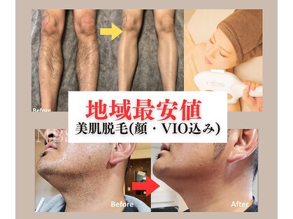 アップベアー(UPBEAR)の写真