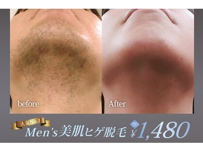 アネル オム 新都心店(ANEL HOMME)の写真