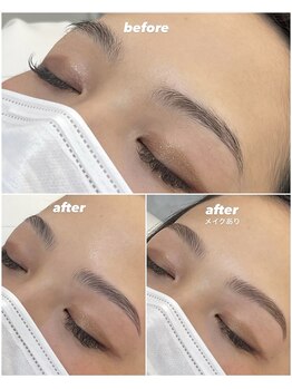 ティニー(Tiny)/HBL