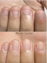 マリーロール 天王寺店(Marie Laure)/自爪育成/深爪矯正/ネイルケア
