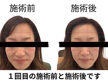 田端整体院/小顔整体/小顔矯正/伊勢崎/