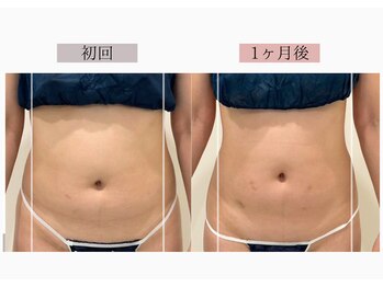 フロリール アザブジュウバン(FlorirAzabujuban)/痩身/脂肪燃焼/くびれ美人