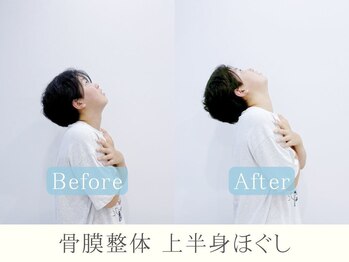 ライト 大森(HLIGHT)/ビフォーアフター