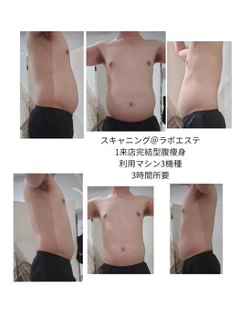 スキャニング@ラボエステ/ぽっこり腹専用メニュー
