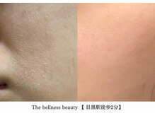 ザ ベルネス(The bellness)/【セルマン取扱認定サロン】