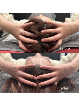 プライミー(PRIMY)/頭蓋骨調節