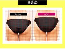 美尻研究所 銀座店の雰囲気（あらゆるお尻のお悩みをご相談下さい！美尻へと導きます。）