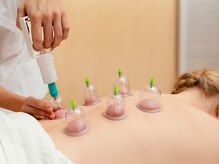 りらく もみのき 清水店/カッピング