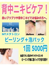 ビューティーサロン リノア(LINOAH)/背中MTピーリング＋泡パック