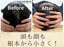 スウ(suu.)/Before-After【40代】7回