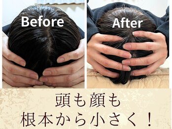 スウ(suu.)/Before-After【40代】7回