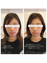 ビュースタイル川西/美容骨格矯正