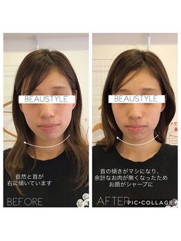 ビュースタイル川西/美容骨格矯正