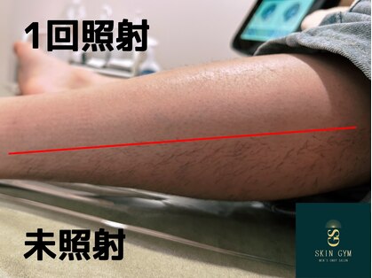 スキンジム(SKIN GYM)の写真