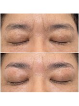 ティニー(Tiny)/HBL