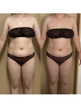 ココア(CoCoa)/活性リンパ洗浄