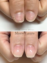 マリーロール 淀屋橋本店(Marie Laure)/自爪育成/深爪矯正/ネイルケア