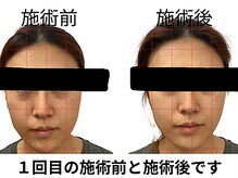 田端整体院/小顔整体/小顔矯正/伊勢崎/