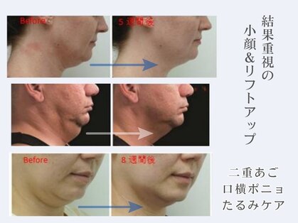 美ネージュの写真