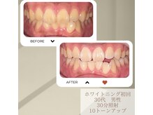 スリール(sourire)の雰囲気（初回からしっかり効果あり*:゜）