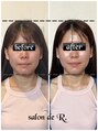 サロン ド アール(salon de R.)&nbsp;本来あるべきところへ土台の骨から立て直るとこんなに変わる◎