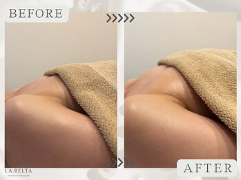 エステティックサロン ラ ベルタ(Esthetic Salon La Belta)/ふんわり美バストケア