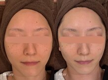 アウラ 小杉店(AULA)/ララピール☆