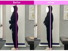 八女整体院/～反り腰・姿勢改善～