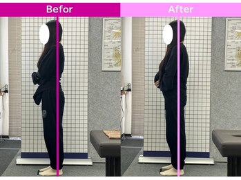 八女整体院/~反り腰・姿勢改善~