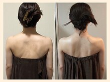 ラフリー 武蔵小杉院(RUFFREE)/ぽっこり肩改善へ【武蔵小杉】