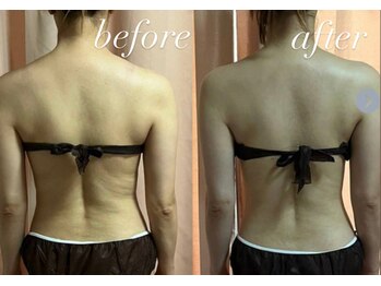 リシェカ(Richeka)/魅せる背中へ