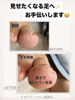 リゼラアンドコー 盛岡店/ドイツ式フットケア専門店